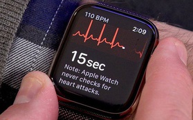Tính năng "ăn tiền" của Apple Watch sắp sử dụng được tại Việt Nam