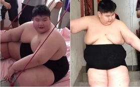 14 tuổi nặng 180kg, cậu nhóc ăn gấp 7 lần người bình thường, phụ huynh phải lên YouTube cầu viện "cứu trợ"