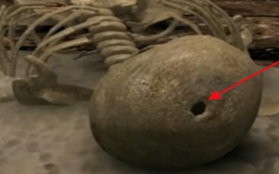 Khai quật ngôi mộ trải vàng ở vùng Tân Cương, đội khảo cổ ngỡ ngàng khi thấy thi hài chủ mộ: Thủng một lỗ giữa sọ!