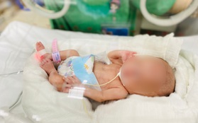 Kỳ tích cứu sống bé gái sinh non nhẹ cân nhất Việt Nam chỉ nặng 400 gram