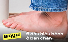 Quiz: 6 điểm bất thường xuất hiện ở bàn chân, nếu có chỉ 1 cái cũng nên cẩn thận, có thể bệnh tật nguy hiểm đang dõi theo bạn