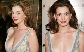 Anne Hathaway nhắc lại khoảng thời gian "bị ghét nhất nước Mỹ"