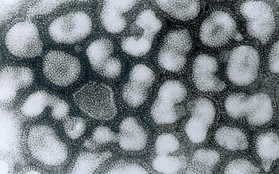 Virus cúm A(H5) gây tỷ lệ biến chứng và tử vong cao
