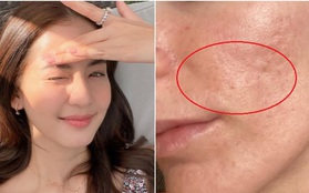 Trẻ hóa da tuổi 35+: Tập trung vào 5 bước này sẽ giúp tăng sinh collagen và làm mờ nếp nhăn