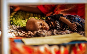 Hai triệu trẻ em ở vùng Sừng châu Phi có nguy cơ bị đói