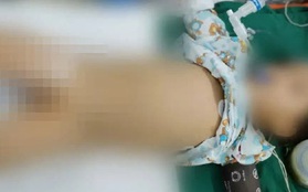 Cậu bé 4 tuổi phải cắt bỏ 1,5 mét ruột non hoại tử, bác sĩ nhắc nhở sau khi ăn chớ làm 5 việc hại gan và dạ dày