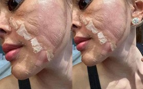 3 nguyên tắc peel da chị em cần nhớ