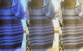 "Trắng xanh" hay "vàng đen": Cách chiếc váy gây tranh cãi nhất mạng xã hội tạo ra đột phá về khoa học thần kinh