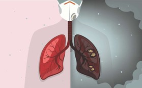 Chưa từng hút có thể ung thư phổi vì khói thuốc: "Thủ phạm" ẩn quanh mỗi người