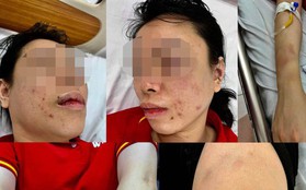 Vụ người phụ nữ ở Hà Nội tố bị "bắt cóc", đánh đập dã man: Chồng cũ nạn nhân khai nhận hành vi