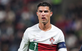 Ronaldo bê bết máu vì bị thủ môn đối phương đấm gãy mũi