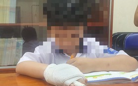 Cơ quan chức năng vào cuộc vụ giáo viên bị tố đánh gãy xương ngón tay học sinh