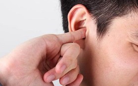 Thanh niên 21 tuổi thủng màng nhĩ do viêm tai giữa từ nhỏ