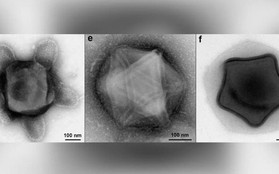 Phát hiện mầm bệnh kinh dị nhất: Virus có xúc tu bạch tuộc