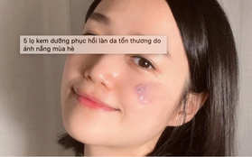 5 lọ kem dưỡng phục hồi làn da tổn thương do ánh nắng mùa hè