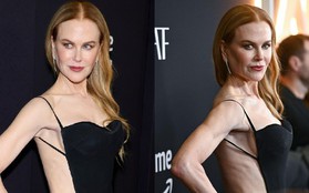 Nicole Kidman bị chê khi mặc váy táo bạo ở tuổi 57