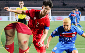 Xót xa hình ảnh Duy Mạnh "trầy da tróc vảy" sau trận tuyển Việt Nam hòa nghẹt thở Philippines tại AFF Cup