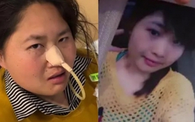 5 năm làm mukbang, ngoại hình cô gái 33 tuổi thay đổi chóng mặt khiến dân mạng cứ ngỡ bà dì trung niên: "Dùng thân xác đổi tiền bạc"