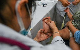 Dịch chân tay miệng bùng phát ở Hà Nội: Hơn 300 ca mắc, 3 điểm trường học đang lây lan nhanh