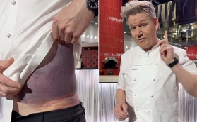 Đầu bếp nổi tiếng Gordon Ramsay gặp tai nạn giao thông nghiêm trọng