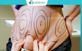 45 phút sau hút mỡ, một người phụ nữ nhồi máu não