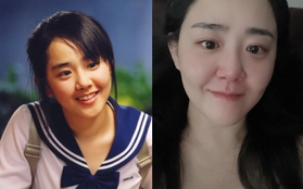 Bức ảnh gây lo lắng tột độ của "Em gái quốc dân" Moon Geun Young