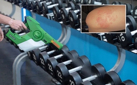 Cô gái đi tập gym vô tình chạm vào một thứ "ẩm ướt", trở về ngứa ngáy gãi đến toạc cả da