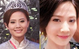 Cựu Hoa hậu Hồng Kông bị nghi gọt mặt