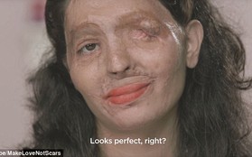 Thông điệp ẩn giấu đằng sau clip makeup của một nạn nhân bị tạt axit