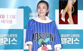 Dara (2NE1) bị soi đôi chân tì vết, đọ sắc cùng Moon Geun Young