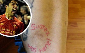 Bị cắn vào chân, bảo vệ quán rượu bất ngờ đổ cho… Luis Suarez
