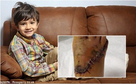Anh: Cậu bé 6 tuổi khóc ròng trong đau đớn vì bị thang cuốn "nuốt" suốt ba tiếng