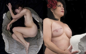 Ám ảnh những chân dung phụ nữ sau phẫu thuật cắt bỏ ngực