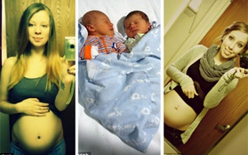 Trùng hợp khó tin: Cặp sinh đôi mang thai và vượt cạn cùng ngày