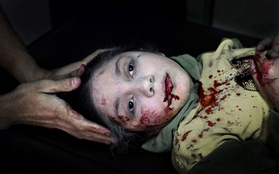 Ánh mắt ám ảnh của bé gái 11 tuổi bị thương trong cuộc nội chiến Syria