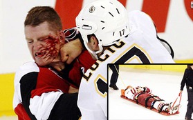 Những “trận chiến” đẫm máu trên sân băng Hockey
