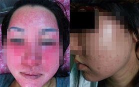 Người phụ nữ có biệt danh Bean và đơn hàng Collagen giả “khủng”