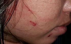 Xử lý nghiêm vụ nữ du khách bị đánh trầy mặt