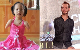 Bé gái có cơ thể giống Nick Vujicic khao khát được gặp anh vào tối nay