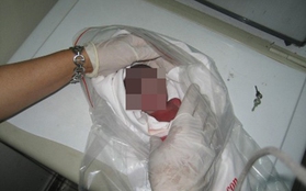 Phát hiện xác thai nhi trong thùng rác giữa phố Hà Nội