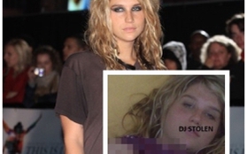 Ke$ha lộ ảnh "nóng"?