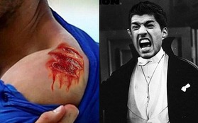 Loạt ảnh chế hài hước về vụ "cẩu xực" của Luis Suarez