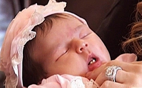 Bác sĩ sững sờ trước bé gái sơ sinh mới chào đời đã mọc 2 răng cửa