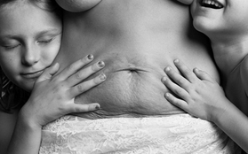 Hình ảnh chân thực về cơ thể của những người phụ nữ sau khi sinh