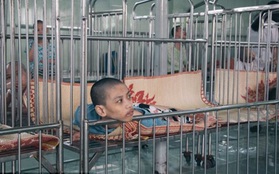 Đau xót hình ảnh trẻ em Việt Nam nhiễm chất độc màu da cam trên báo nước ngoài