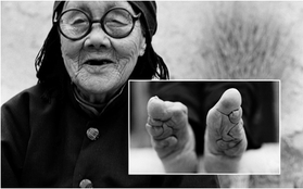 Bộ ảnh về những nhân chứng cuối cùng của tục bó chân tại Trung Quốc