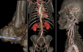 Xem ảnh chụp não, động mạch, tim "động đậy" trong cơ thể người
