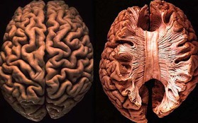 Top 10 điều "thú vị nhưng sai bét" về não bộ con người