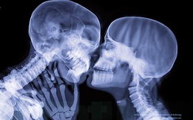 Khám phá vẻ đẹp "xương tủy" của cơ thể người qua ảnh chụp X-quang