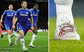 Mourinho "ca ngợi" đôi giày loang lổ máu của Ivanovic